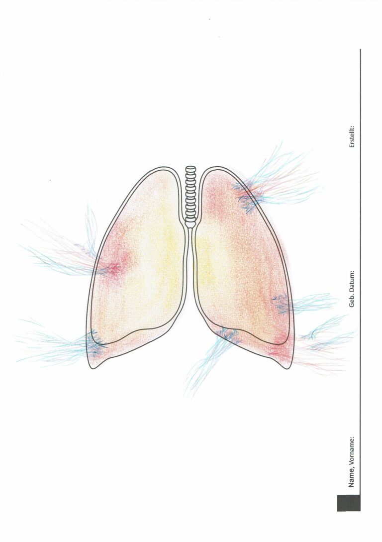 Lunge behandelt mit der NW-H – Methode